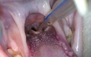 Intubación con sonda urinaria de 2 mm Intubación con sonda urinaria de 2 mm