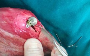 Realización de una cirugía de ligamento cruzado (TTA) y luxación de rótula. Realización de una cirugía de ligamento cruzado (TTA) y luxación de rótula.