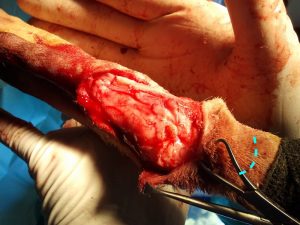 Línea por donde se realizará la incisión de descarga para cerrar un gran defecto de piel tras extirpar un tumor en el carpo Línea por donde se realizará la incisión de descarga para cerrar un gran defecto de piel tras extirpar un tumor en el carpo