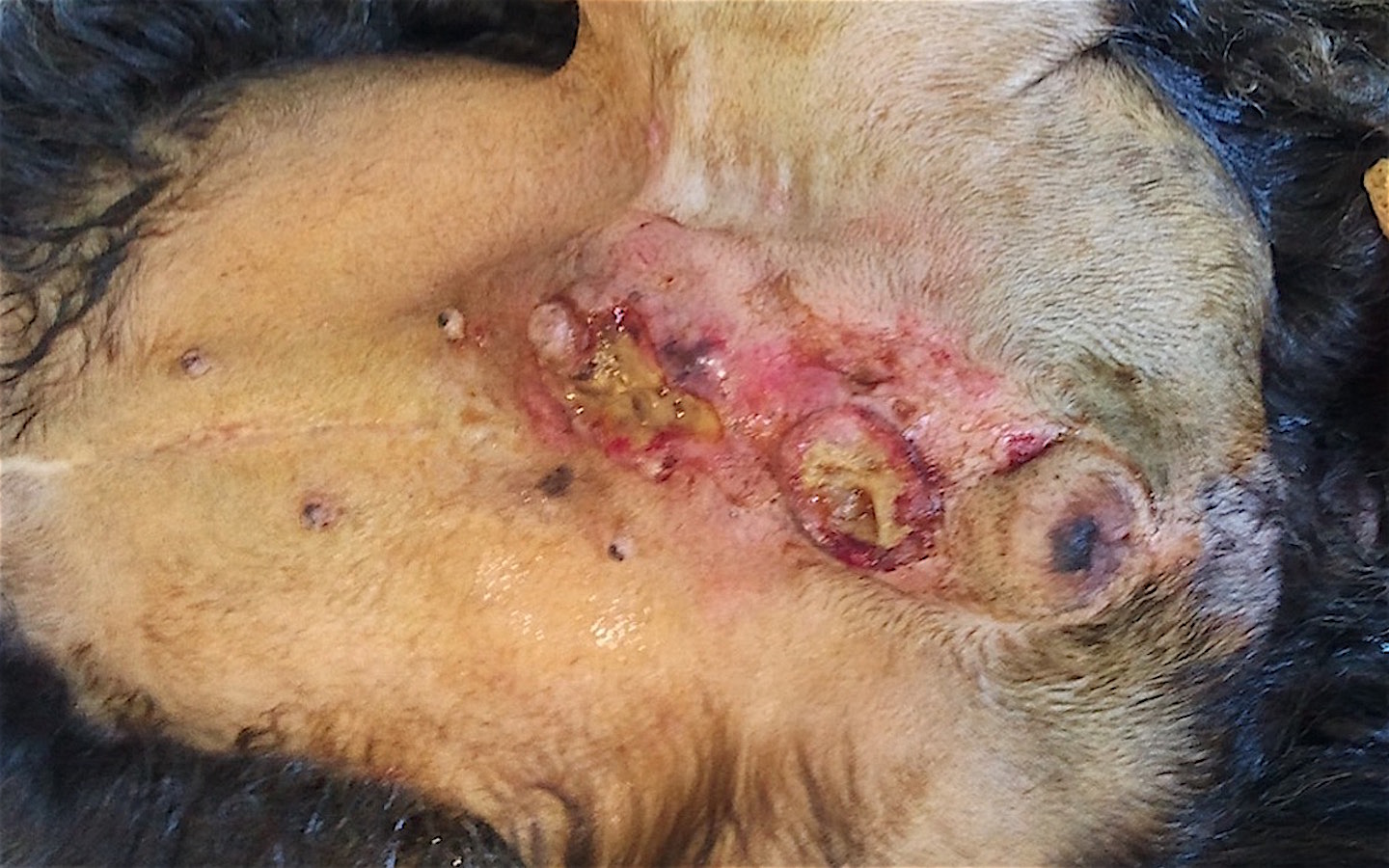 Carcinoma inflamatorio ulcerado y doloroso extirpado tras antibioterapia. Solución paliativa.
